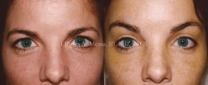 Plastic Surgery Treatments to Make You More Youthful - Featured Image