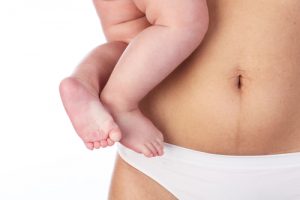 How Can a Body Lift Help After Pregnancy? - Featured Image