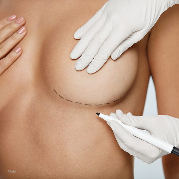 Implant Removal Featured Model