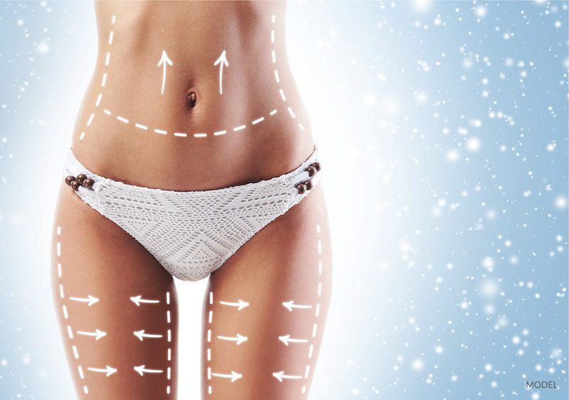 Is Non-surgical Fat Removal Worth the Hype? - Featured Image
