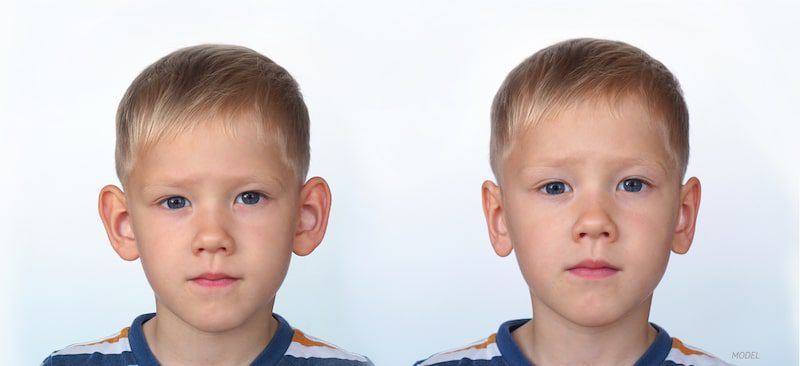 Is My Child Ready for Otoplasty?