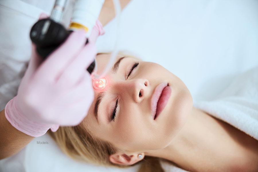 Beautiful woman lying back with her eyes closed while a service provider performs a laser treatment on her upper face